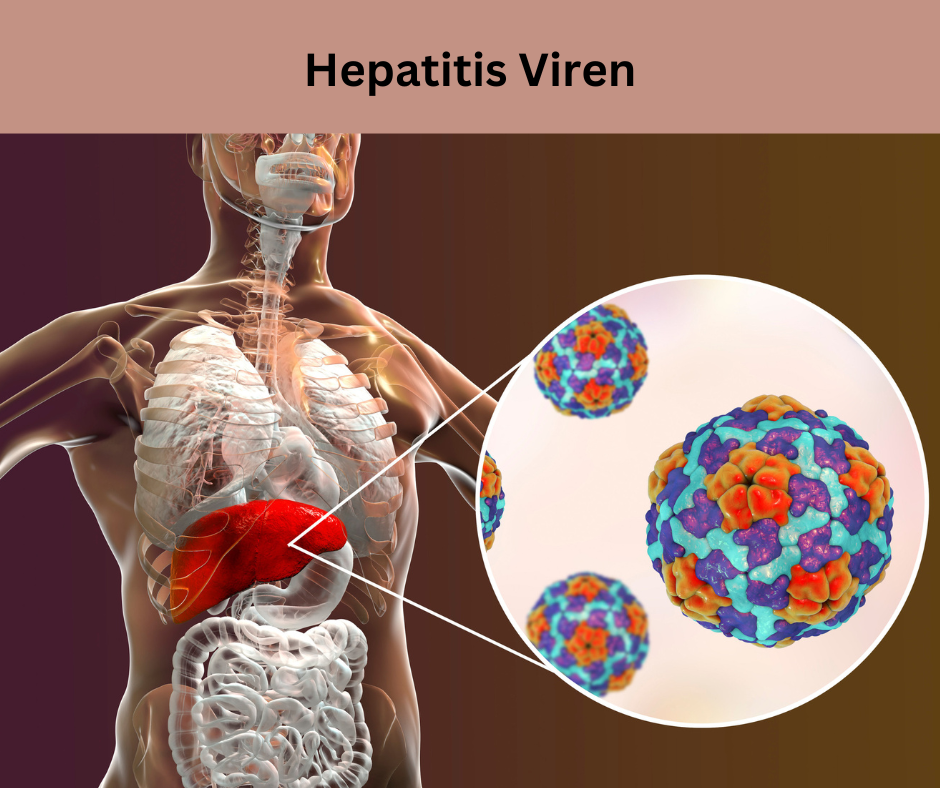 Kranke Leber durch Hepatitis Viren.
