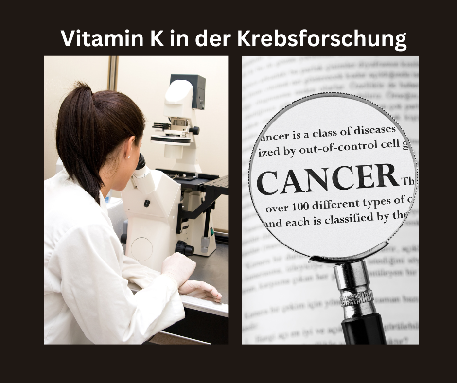 Laborantin am Mikroskop im Labor.  Vitamin K in der Krebsforschung.